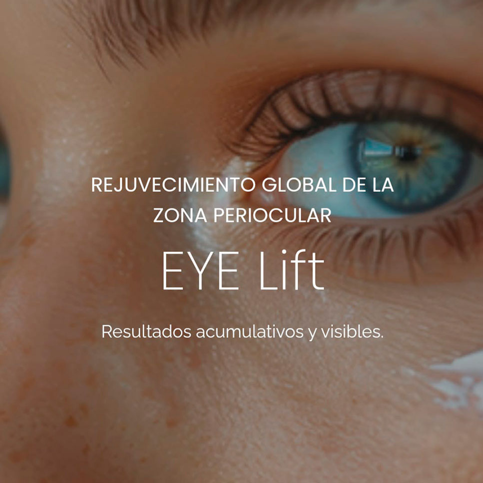 Tratamiento lifting de ojos