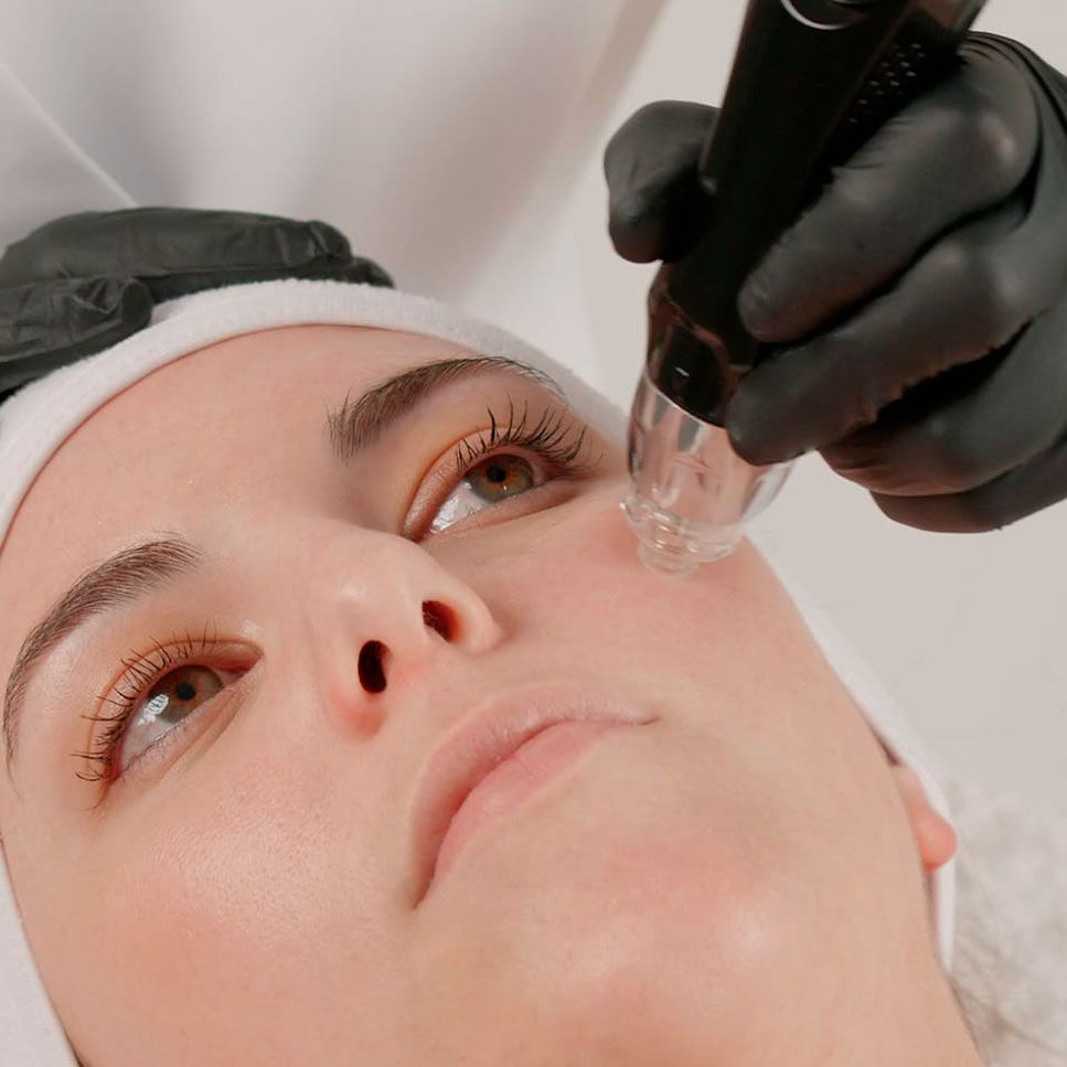 Tratamiento de belleza personalizado