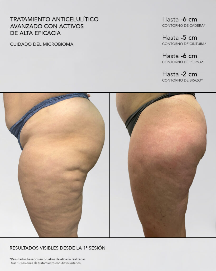 Tratamiento electroporación